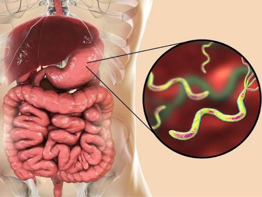 The Most Important Symptoms of Helicobacter Pylori