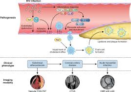Image result for HIV Pathophysiology