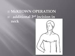 Kevin began his career with mccoy's in 1990. Dr B Ramdas Rai Prof Unit Chief Ymch Ppt Download