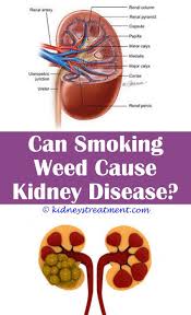 Pin On Kidney Disease Signs