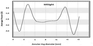 Coopervision is offering a free trial contact lens offer to website visitors. Slowing The Progression Of Myopia In Children With The Misight Contact Lens A Narrative Review Of The Evidence Springerlink