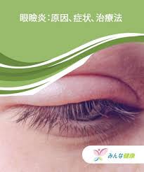 眼瞼炎 原因 症状 治療法 みんな健康 眼瞼 治療 皮脂腺