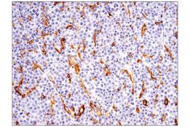 For over 30 years, the member companies of the ihc group have provided health, life, disability, dental, vision, short term medical and hospital indemnity insurance solutions to individuals and groups. Cd14 D7a2t Rabbit Mab Ihc Formulated Cell Signaling Technology