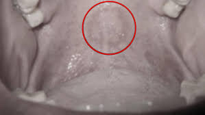 Sexo: Lesión por felación: el insólito descubrimiento en la consulta del  dentista