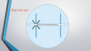 Schick test meaning, definition & explanation. Diphtheria And Elek S Gel Precipitation Test Youtube