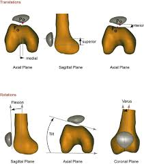 Image result for Patellar Tilt Test
