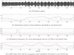 Image result for Cheyne-Stokes Respiration