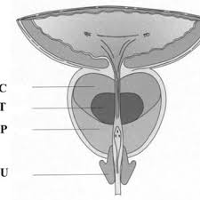 Società italiana di anatomia patologica e citopatologia diagnostica/international academy of pathology, italian division (siapec/iap). Anatomia Zonal De La Prostata Segun Mcneal Zc Zona Central Zt Zona Download Scientific Diagram
