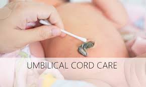 How to care for umbilical cord. How To Care For Your Newborn S Umbilical Cord Urban Mamaz
