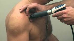 Tout est dans la prévention. Guerir Une Tendinite De L Epaule Par Les Ondes De Choc Radiales Video