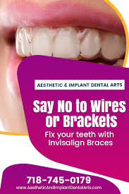 Why Choose Invisalign Braces For Your Teeth In 2020 Invisalign Braces Invisalign Clear Braces