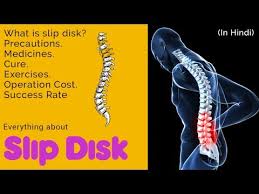 Check spelling or type a new query. Slip Disk Problem What How Operation Cost Medicine Exercise Hindi Youtube