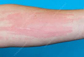 Image result for Wheal