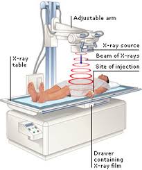 Image result for Intravenous Pyelogram