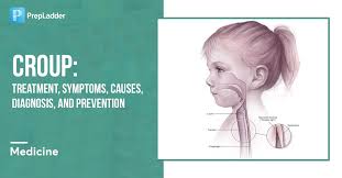 Image result for Croup