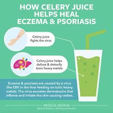 How Celery Juice Helps Heal Eczema Psoriasis Celery Juice Eczema Psoriasis Detox Juice