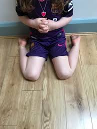 Image result for In-Toeing