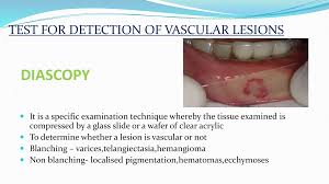 Image result for Diascopy