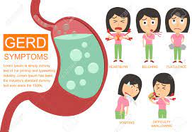 Check spelling or type a new query. Gastroesophageal Reflux Disease Gerd Infographic Gerd Symptoms Infographic Elements Woman Royalty Free Cliparts Vectors And Stock Illustration Image 91024473