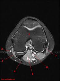 Rubin da, kettering jm, towers jd, britton ca: Atlas Of Knee Mri Anatomy W Radiology