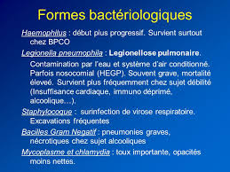 Mettre une cartouche charbon mais un problème en plus d'entretien une cruche brita ? Infections Respiratoires Ppt Telecharger
