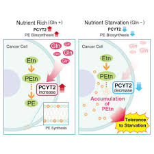 It is mainly wealthy countries, you see, that have aggressively screened their. Phosphoethanolamine Accumulation Protects Cancer Cells Under Glutamine Starvation Through Downregulation Of Pcyt2 Sciencedirect
