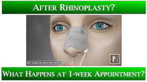 We did not find results for: 1st Appointment After Rhinoplasty 1 What Happens Stitches Taping Nose Anti Swelling Medicine Youtube