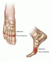 Pin On My Hands Feet Hurt