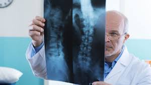 Help For Spinal Arthritis Back Pain Center Everyday Health