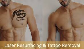 You will usually need to wait for several weeks as your skin heals and renews itself. Laser Resurfacing Treatment Tattoo Removal Treatment