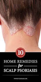 12 Best Home Remedies To Improve Scalp Psoriasis Effectively Natural Psoriasis Remedies Home Remedies For Psoriasis Natural Psoriasis