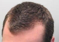 Here is one comment i found  my parents 80 and 82, are both growing new dark hair after taking 400 mg of co q10 for 2 months. 10 Hair Growth Ideas Grow Hair Hair Growth Hair Loss Remedies