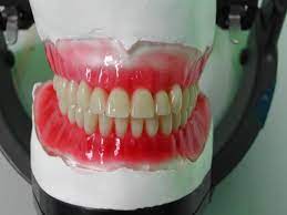 We did not find results for: Jaga Gigi Palsu Ia Bukan Hanya Pelengkap Senyuman Si Pemakai Famili Mstar