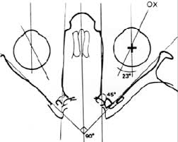 Understanding The Causes Of Vertical Diplopia