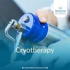 Image result for Cryotherapy
