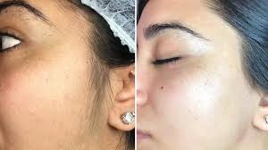 Facial in Altamonte Springs