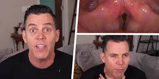Steve-O Talked to a Doctor About Why His Voice Is So 'Messed Up'