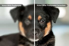 Image result for Presbyopia
