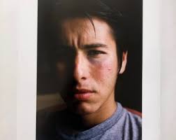 Leo Romero, Portrait with Black Eye, Chicago, IL, 2006