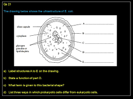 Check spelling or type a new query. Qs 21 The Drawing Below Shows The Ultrastructure Of E Coli Ppt Video Online Download