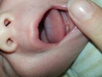 Soor Forum Baby Urbia De