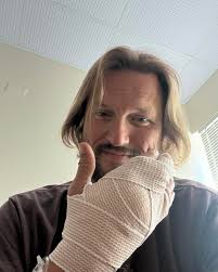 Man loses fingers in street bike accident