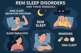 Image result for REM Sleep Behavior Disorder