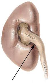 Våre mobile applikasjonen demonstrerer terapeutiske øvelser for de med bare øvre smerter i rygg regionen. Fakta Om Nyrestein Nettdoktor