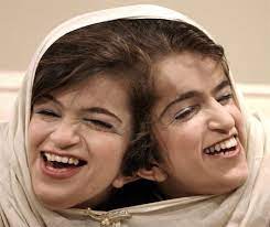 Doctors begged the twins ladan and laleh bijani not to go ahead with surgery to separate their fused heads, it was revealed last night. Ein Prominenter Fall Aus Jungerer Zeit Sind Die Am Kopf Zusammengewachsenen Schwestern Ladan Und Laleh Bijani