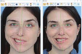 The politics of not curing bell's palsy. Case Example Of A Patient With Aberrant Recovery From Left Sided Bell Download Scientific Diagram