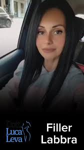 Le mi pazienti sono felici 🙂con le loro nuove labbra. Modellamento con  acido ialuronico Dott. Luca Leva specialista in Chirurgia Plastica  Ricostruttiva ed Estetica. 📞3495650365. ...