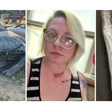 Fundraiser by Grace Kifer : Help with medical bills after a hit-and-run  wreck