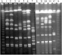 Toutes les informations utiles d'accès, tarifs et horaires pour consulter et se faire soigner au centre médical de l'institut pasteur. Legionella Anisa A Possible Indicator Of Water Contamination By Legionella Pneumophila Journal Of Clinical Microbiology