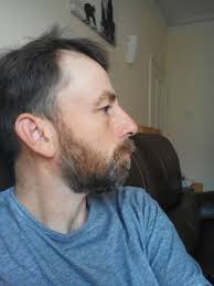 The beard is back. 2 years of smooth chin ended.